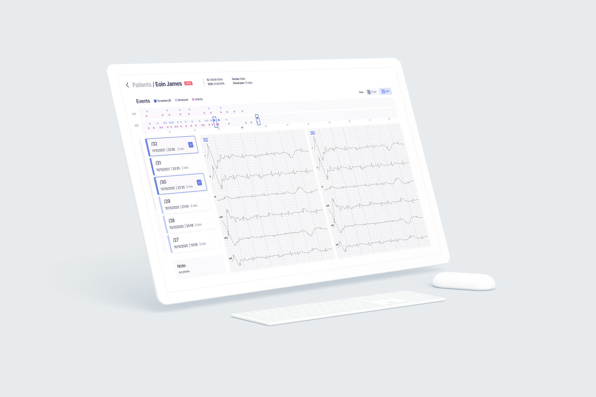 Viscero - ECG Vest