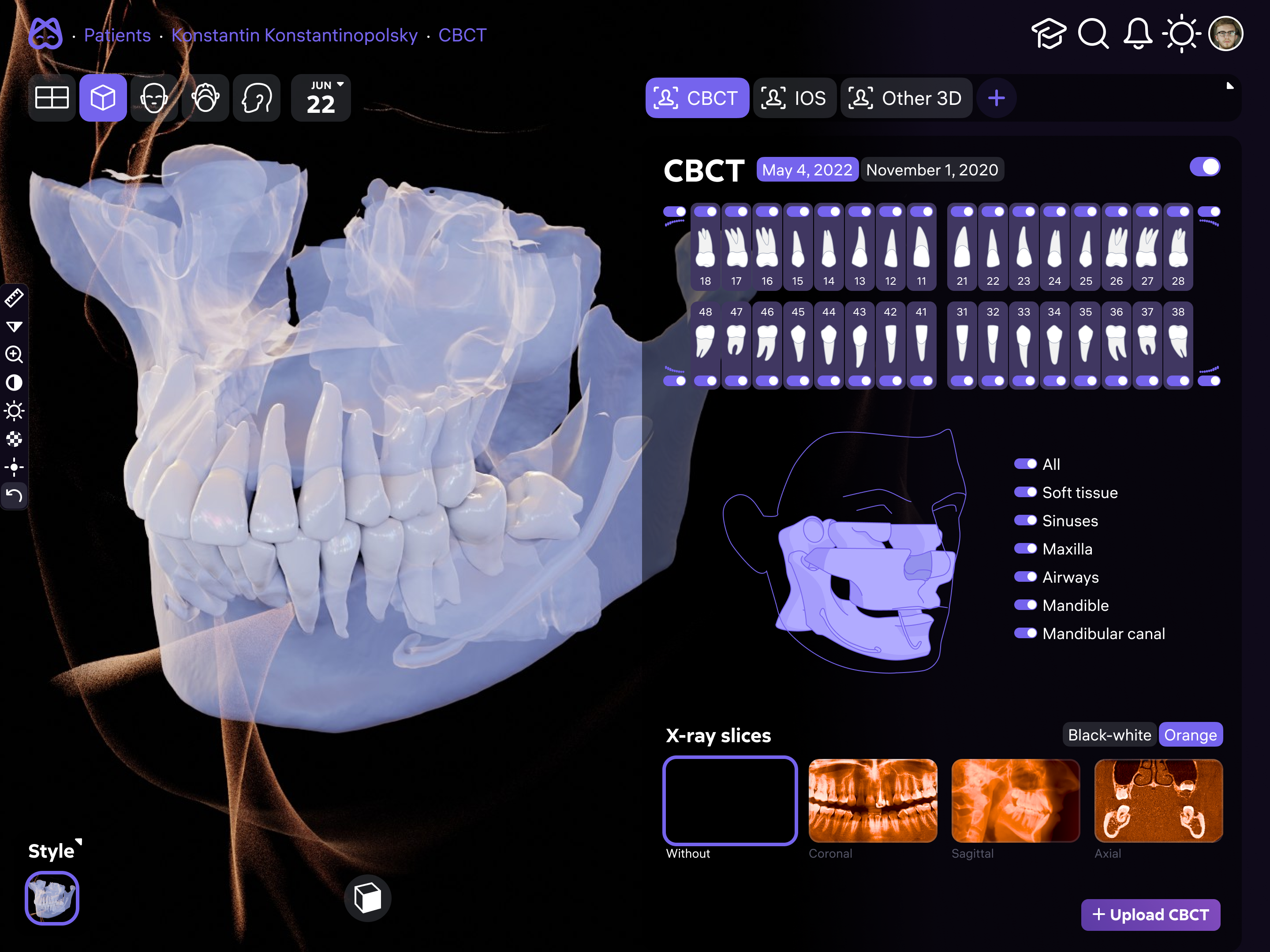 Diagnocat dental analysis system
