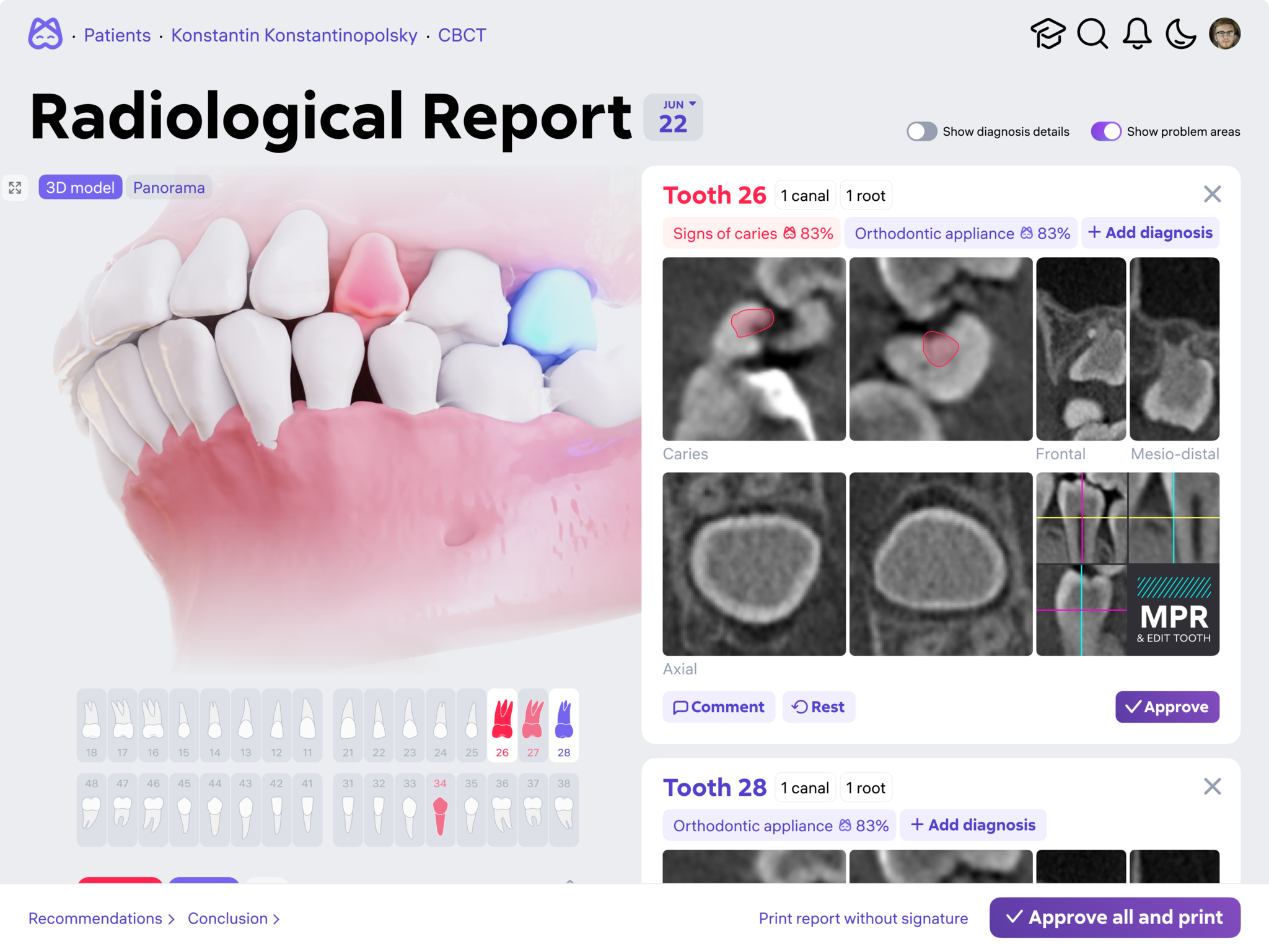 Diagnocat dental analysis system